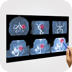 Ангиография